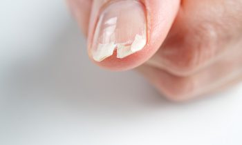 Impactul unghiilor cu gel asupra unghiilor naturale